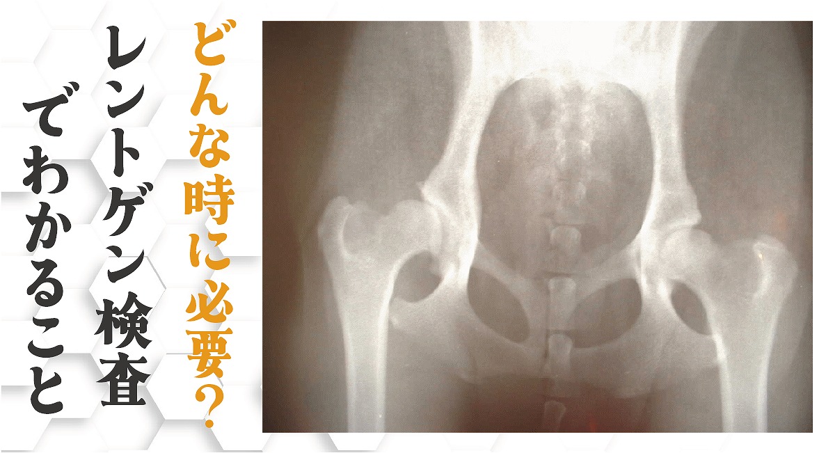 犬のレントゲン